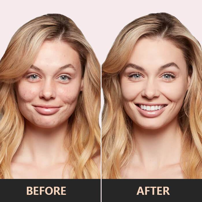 1+1 Gratis | SkinBlend™ | Jugendliches Aussehen