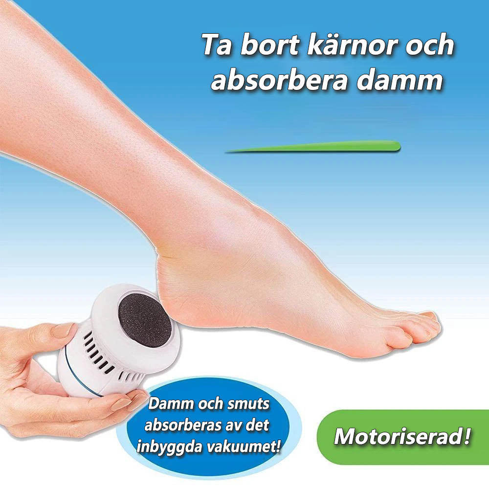 SoleSmooth™ | Hornhautentferner