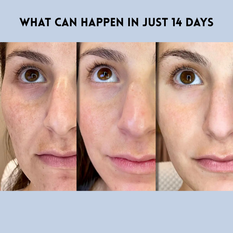 FirmPatch™ | Sicher ohne Falten