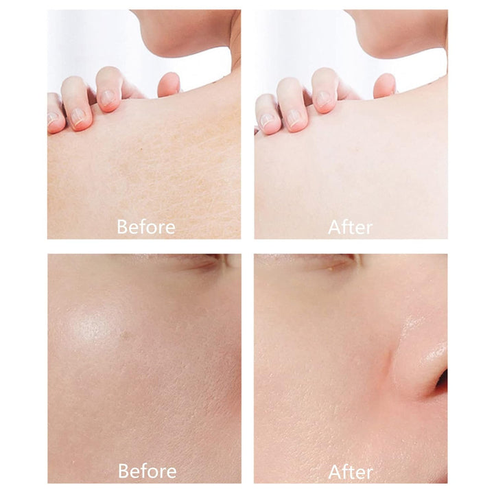 1+1 GRATIS | Derol™ | Für jugendlichen Glow-Boost und strahlende, gesunde Haut