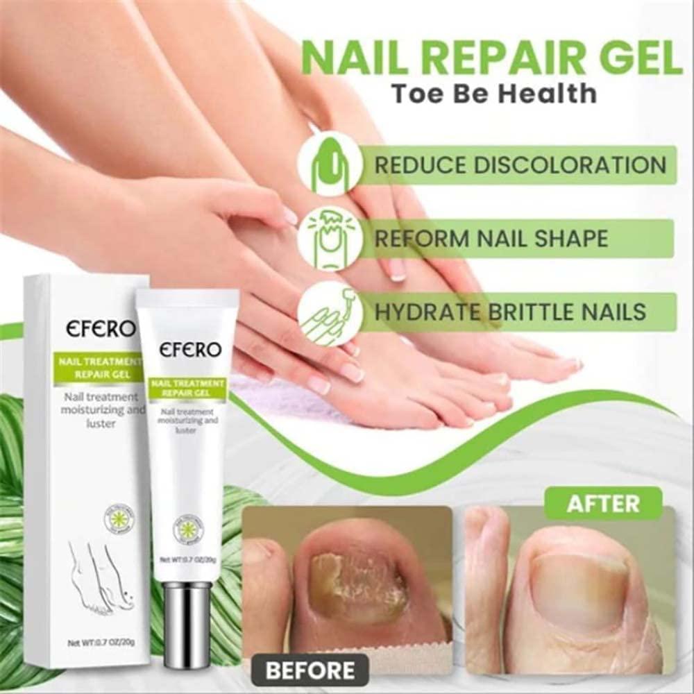 1+1 Gratis  | RejuveNail™ | Erhöht die Festigkeit für gesunde, schöne Nägel!