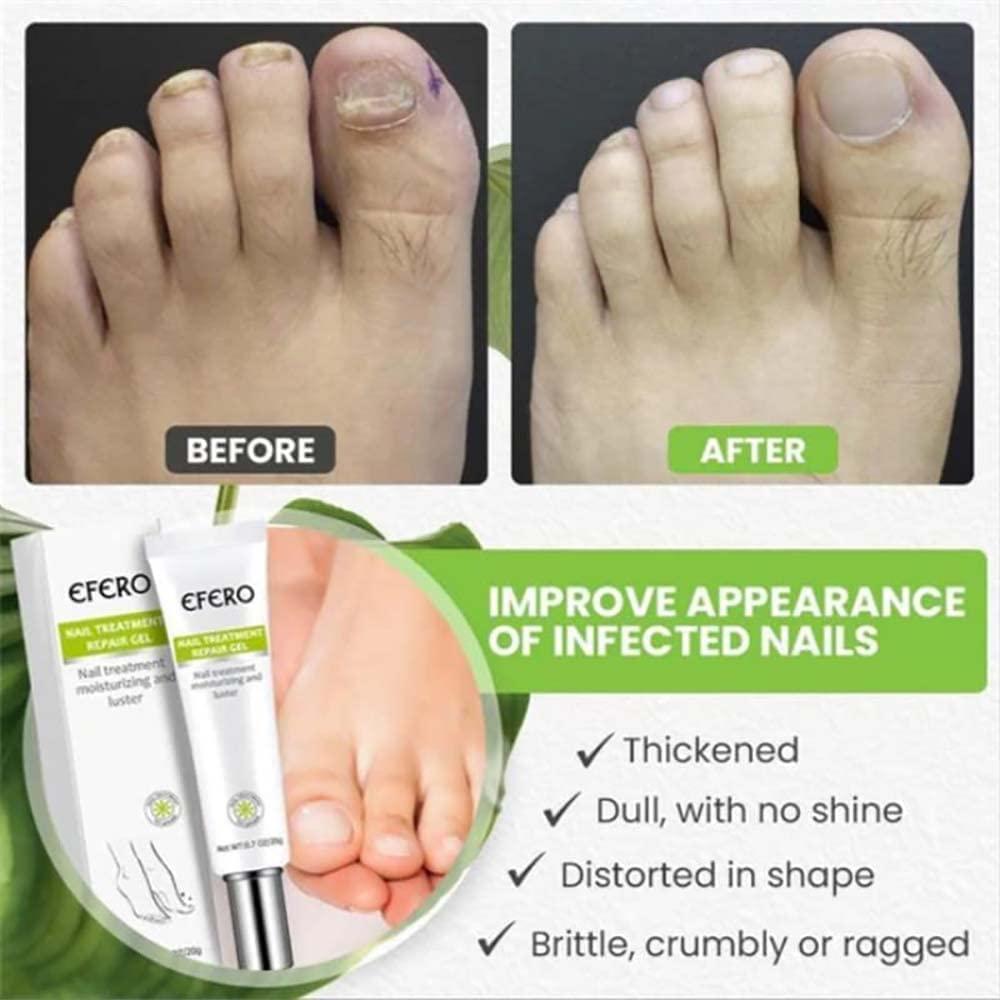 1+1 Gratis  | RejuveNail™ | Erhöht die Festigkeit für gesunde, schöne Nägel!
