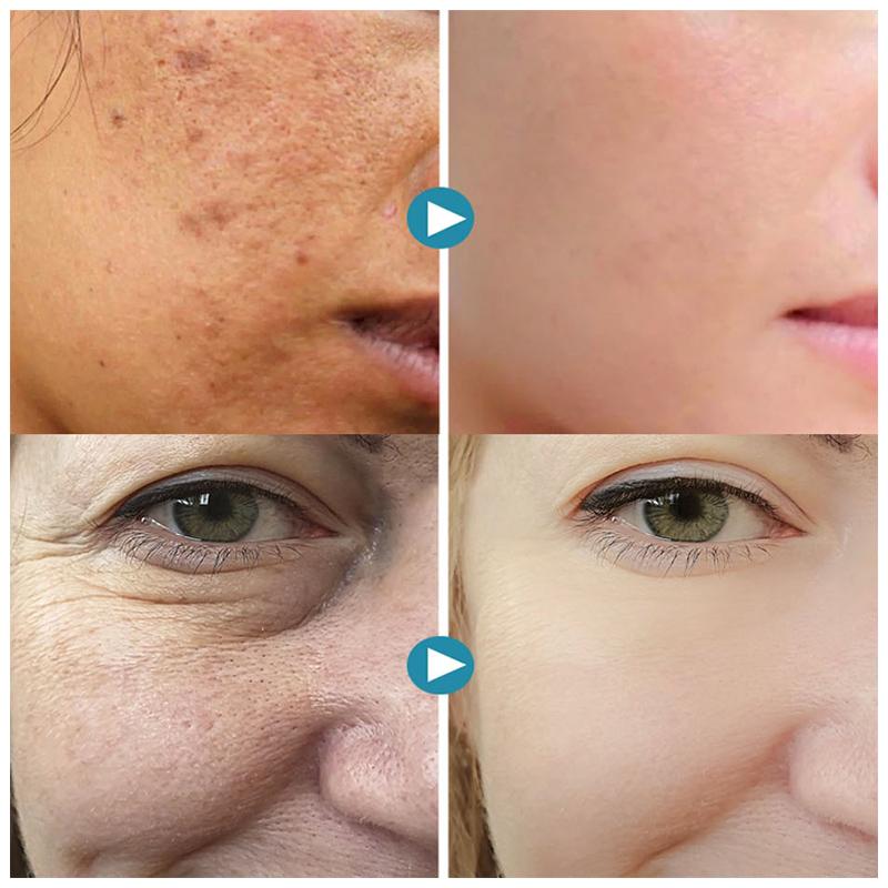 1+1 Gratis | SilkyPores™ |  Sofortige Porenminimierung