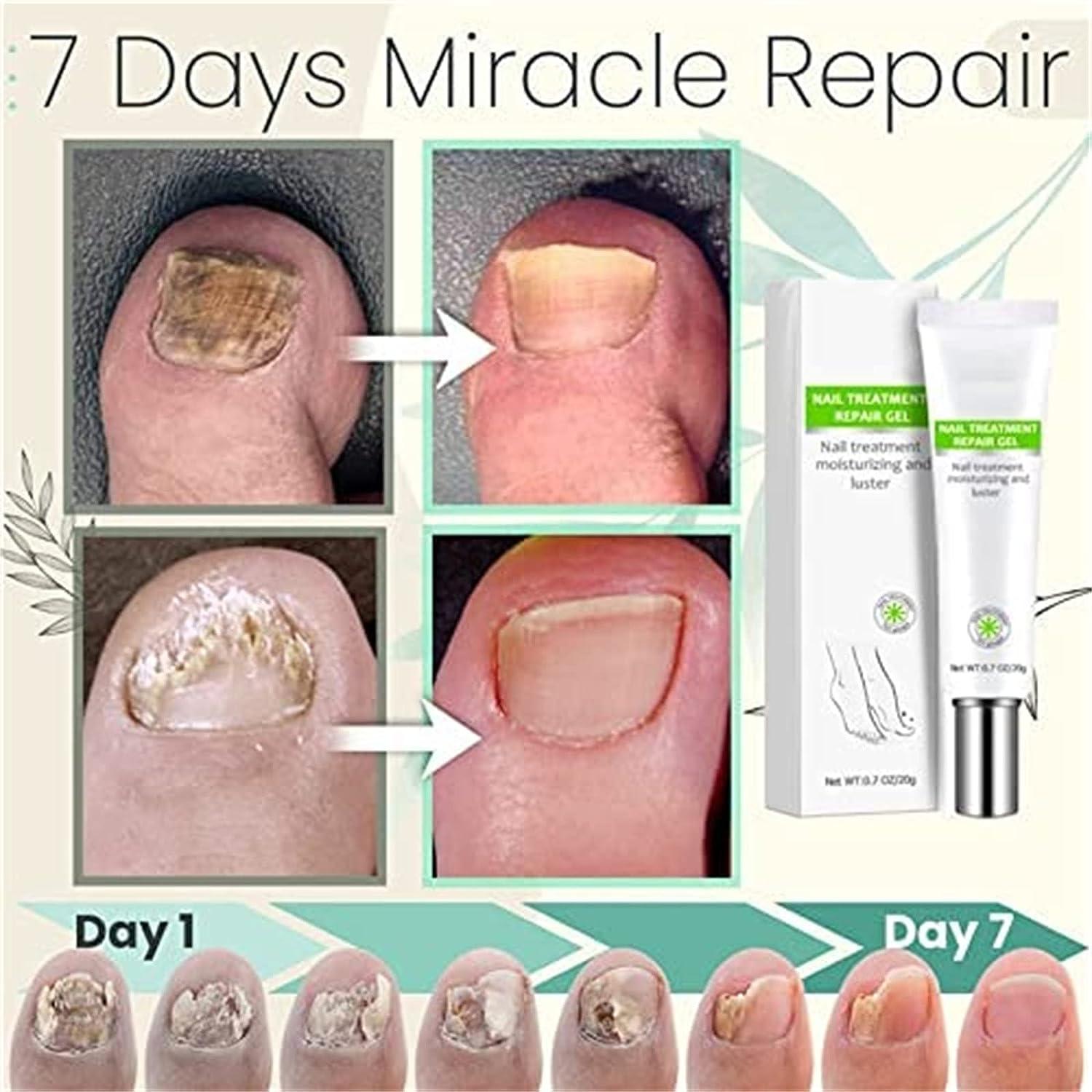 1+1 Gratis  | RejuveNail™ | Erhöht die Festigkeit für gesunde, schöne Nägel!