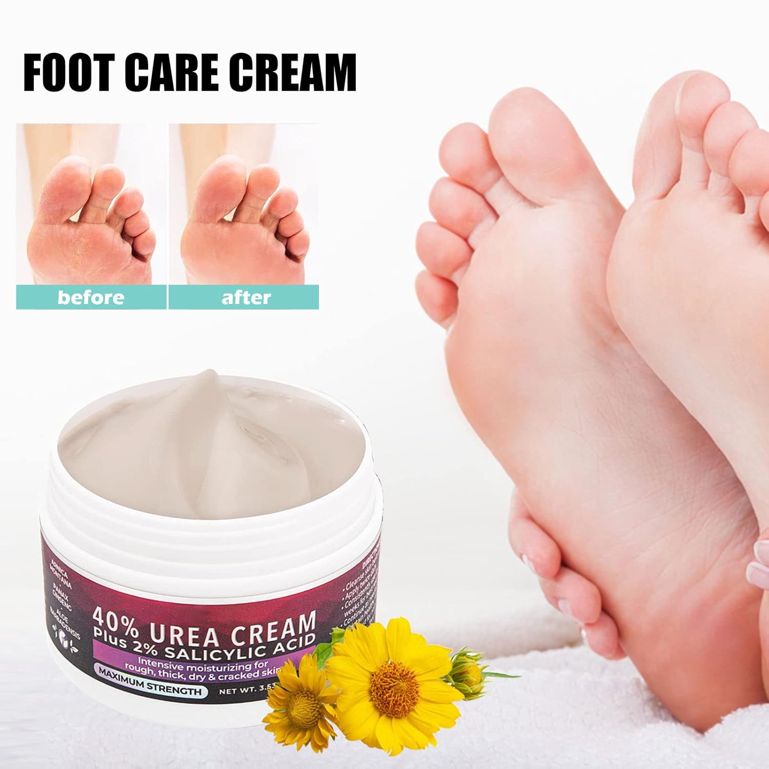 1+1 GRATIS | Medical Foot Care Cream™ | Heilt und schützt rissige Haut für langanhaltenden Komfort