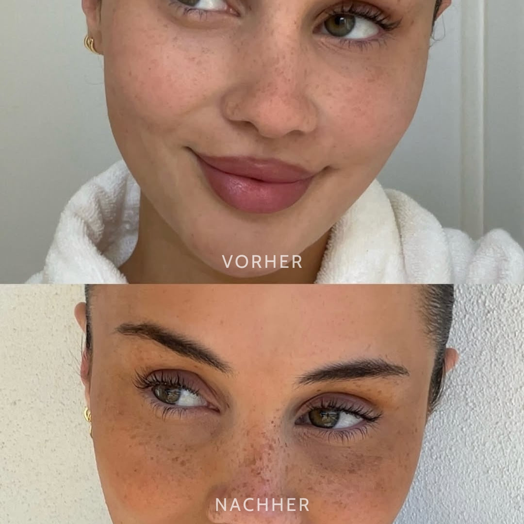 SpeckleTouch™ | Verspielte Schönheit Akzent