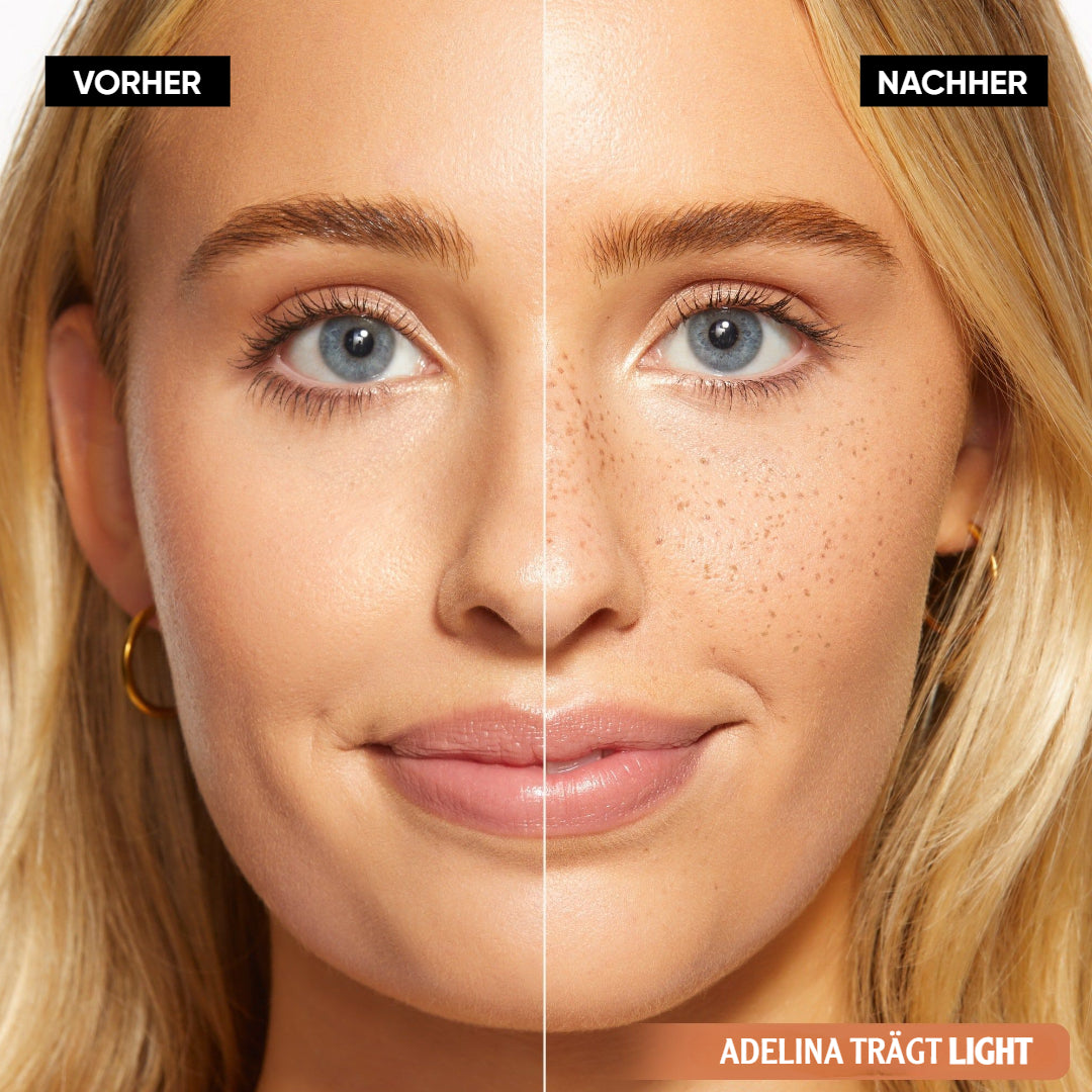 SpeckleTouch™ | Verspielte Schönheit Akzent