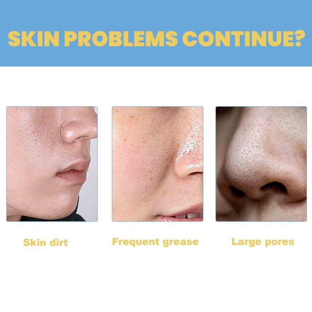 5+5 Gratis | DeepPurify™ | Klärendes Serum — Löst Mitesser für Glatte, Strahlende Haut