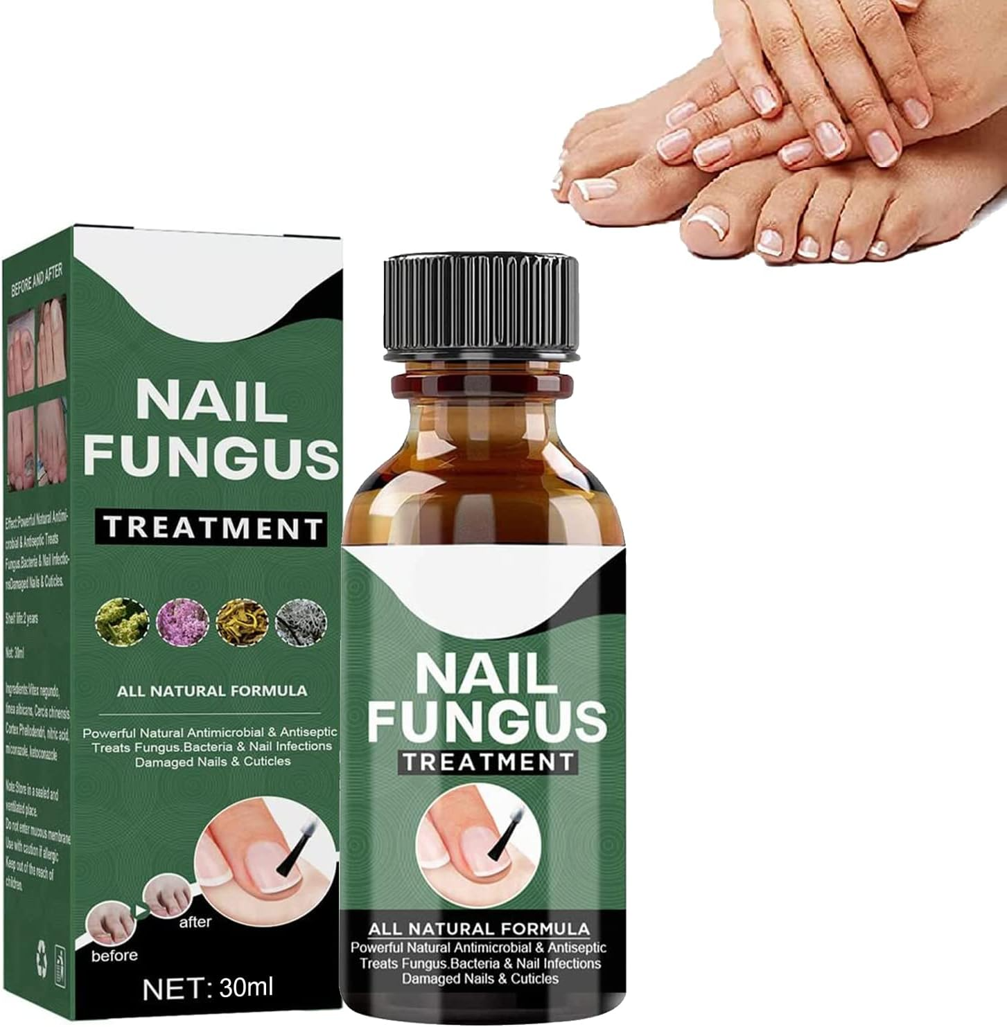 50 % Rabatt | NagelPilz™ | Heilt, restauriert & schützt beschädigte Nägel
