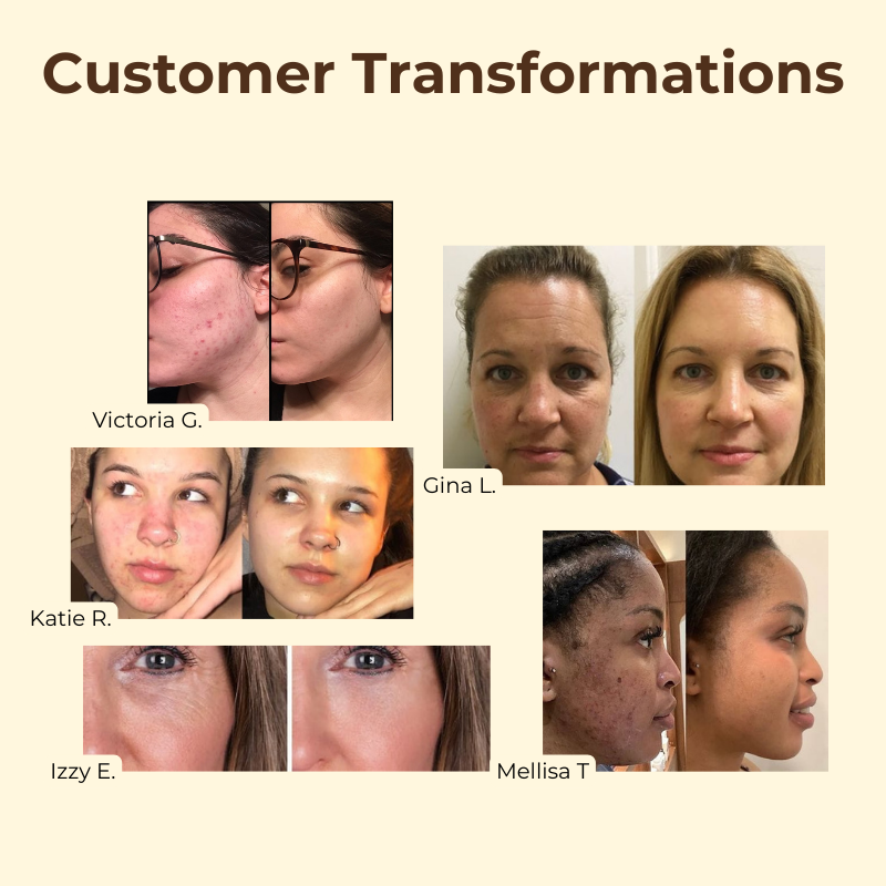 1+1 GRATIS | TeaElixir™ | Schwarzer Tee Gesichtsmaske für strahlende, feste & gereinigte Haut | Luxuriöse Pflege mit Anti-Aging- & Feuchtigkeitswirkung