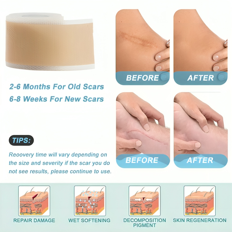 1+1 Gratis | Dermiva | Silikon-Narbentücher