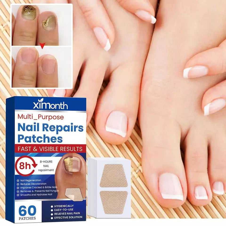 1+1 Gratis | Nailox™  | Wirksame Behandlung von Nagelpilz