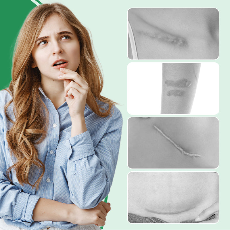 1+1 Gratis | Scarify™ | Wiederverwendbare Silikon-Littekenspflaster für makellose Haut