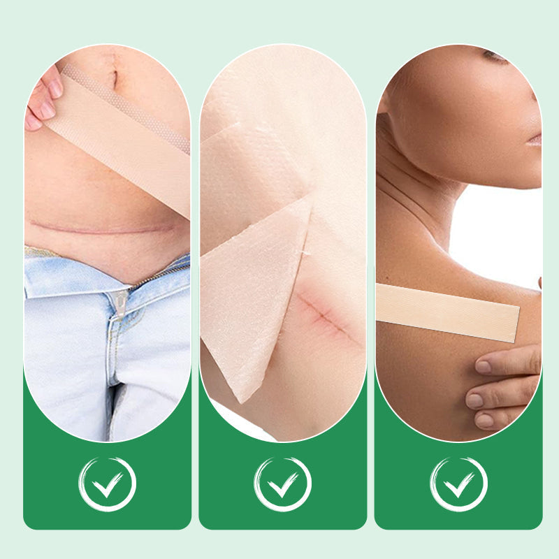 1+1 Gratis | Scarify™ | Wiederverwendbare Silikon-Littekenspflaster für makellose Haut